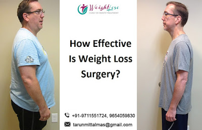 How Effective Is Weight Loss Surgery?