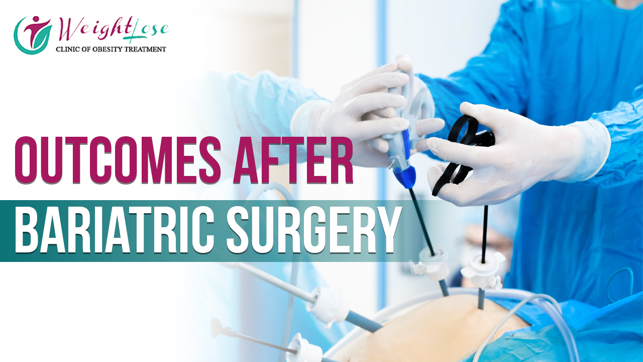 Outcomes after Bariatric Surgery