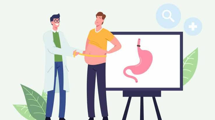 Are You a Suitable Candidate for Bariatric Surgery?