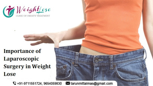 Importance Of Laparoscopic Surgery in Weight Lose