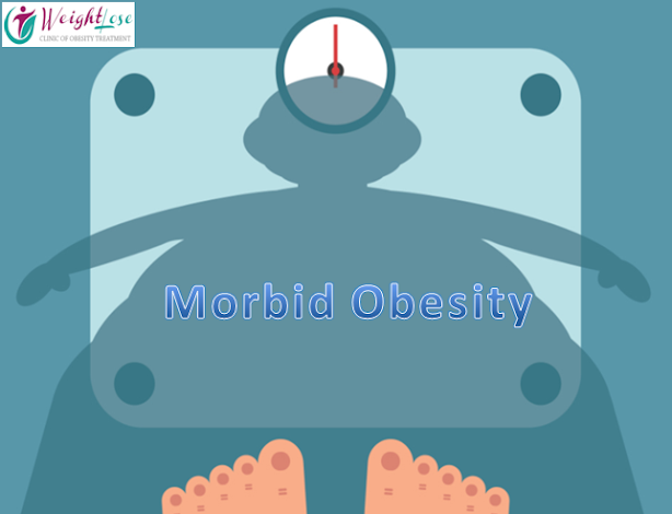 Morbid Obesity
