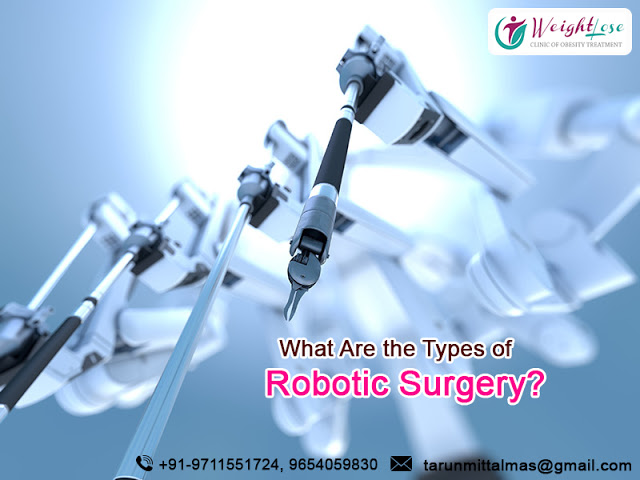 What Are The Types of Robotic Surgery ?