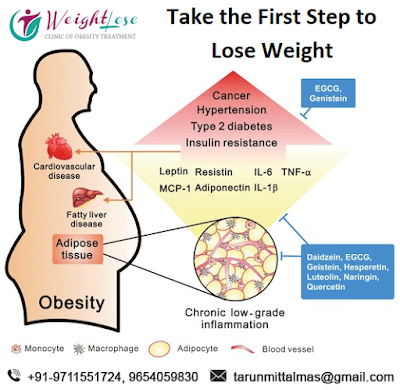 Take The First Step To Lose Weight