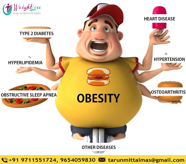 What Health Problems Can Obesity Cause?