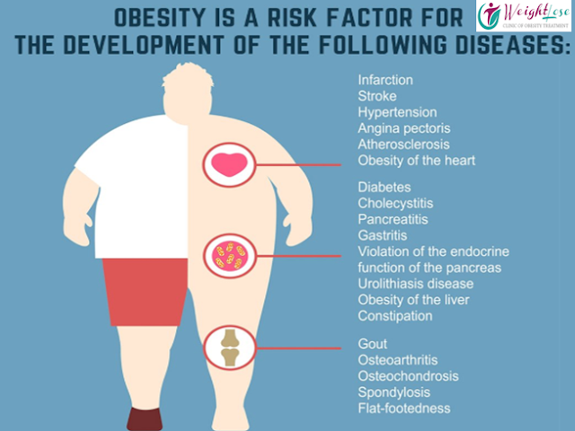Why Obesity Is a Health Problem