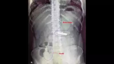 Razor Removal