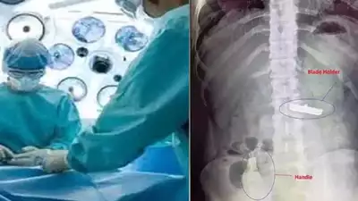 Razor Surgery
